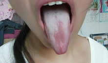 舌头烂了的图片