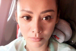 宁静整容前照片,整容前后对比，探寻美丽背后的故事