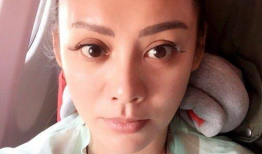 宁静整容前照片,整容前后对比，探寻美丽背后的故事